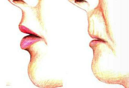aging lips treatment